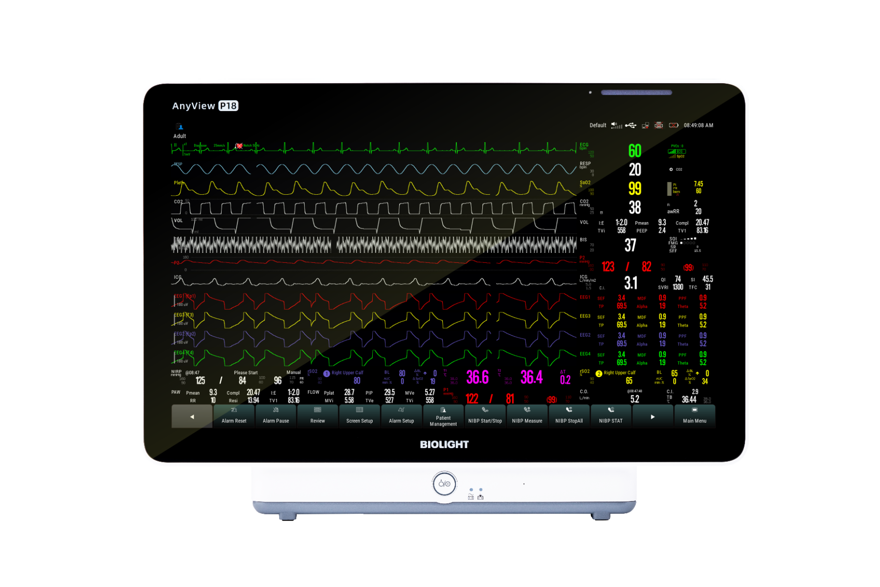 Monitor functii vitale Biolight Anyview P18