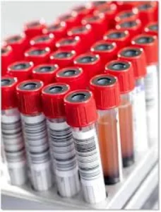 Vacutainer biochimie 4 ml